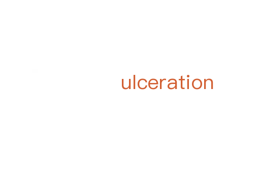 ulceration